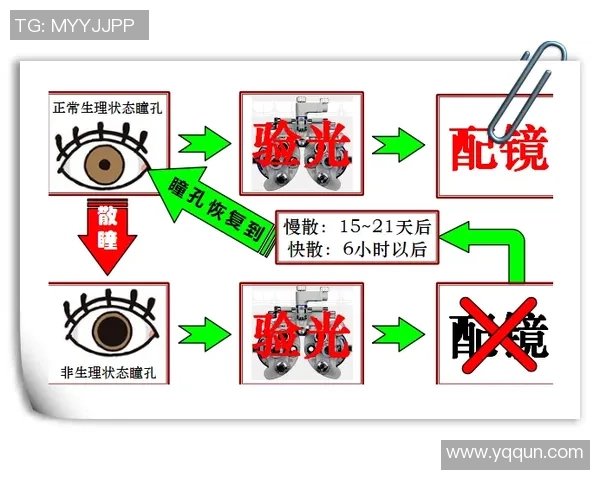 慢散瞳后能否安全打篮球对眼睛健康的影响与注意事项解析 慢散瞳后能否安全打篮球对眼睛健康的影响与注意事项解析